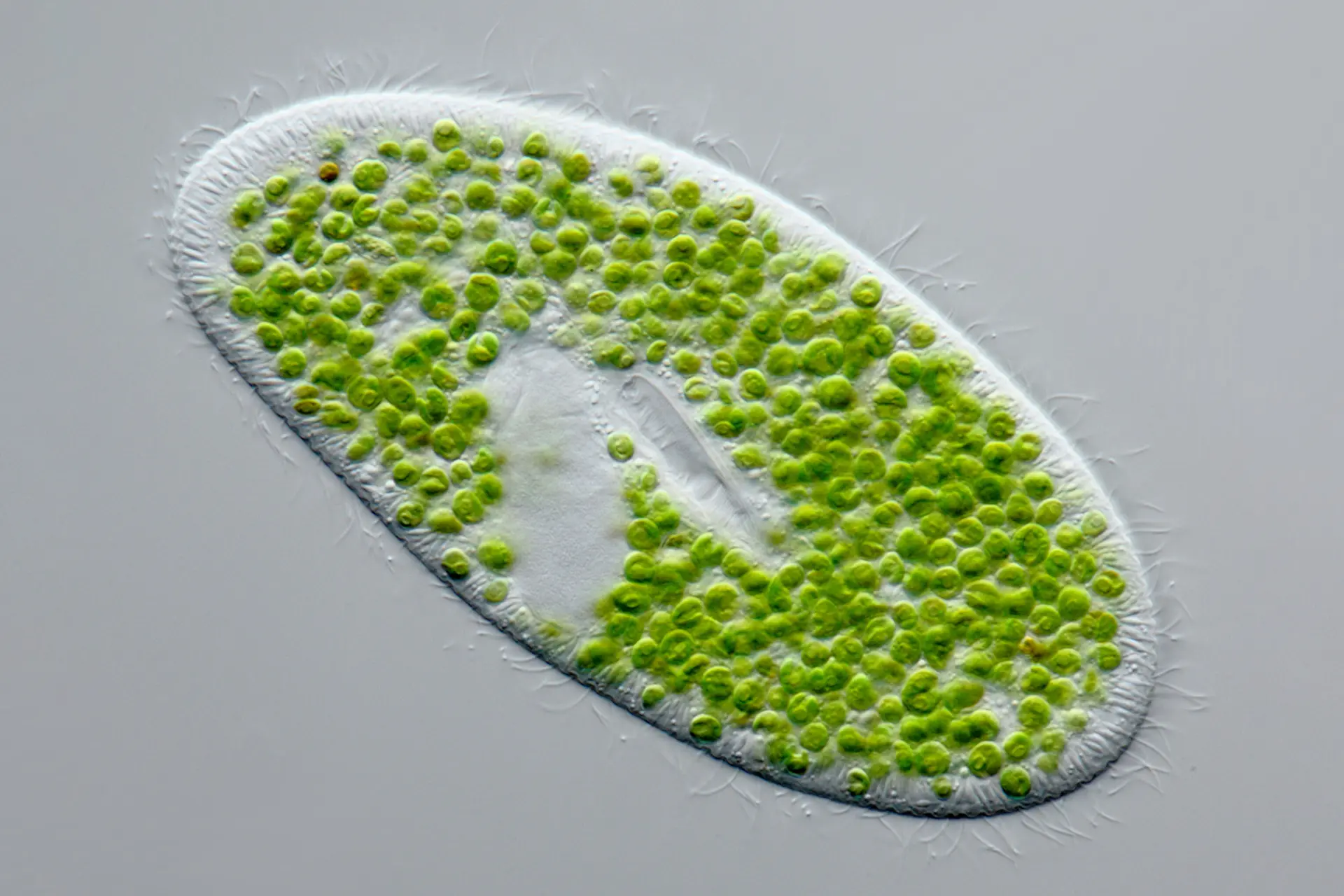 Incluso los organismos unicelulares como el paramecio demuestran comportamientos intencionados como nadar, evitar obstáculos, aparearse y aprender sin tener una sola sinapsis o ser parte de una red neuronal. (Proyecto Agua/ <a href="https://www.flickr.com/photos/microagua/" target="_blank" rel="noopener">CC BY-NC-SA 2.0</a>)