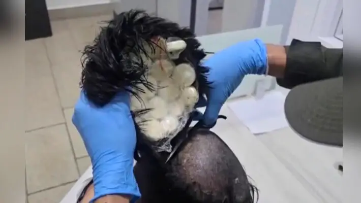 La policía colombiana detiene a un hombre que contrabandeaba paquetes de cocaína bajo su peluquín en el aeropuerto de Cartagena, Colombia, el 24 de febrero de 2025, en esta captura de pantalla tomada de un vídeo. (Vía Policía Nacional de Colombia)