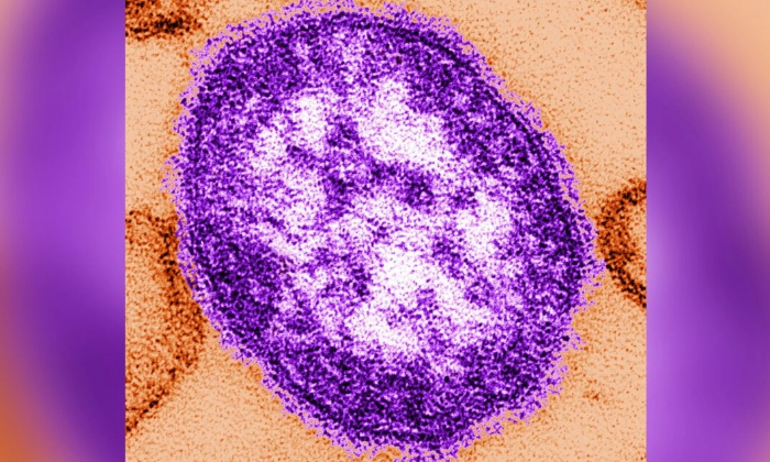 Una micrografía electrónica de transmisión (MET) de sección delgada revela el aspecto ultraestructural de una sola partícula vírica, o «virión», del virus del sarampión. (CDC vía Getty Images)