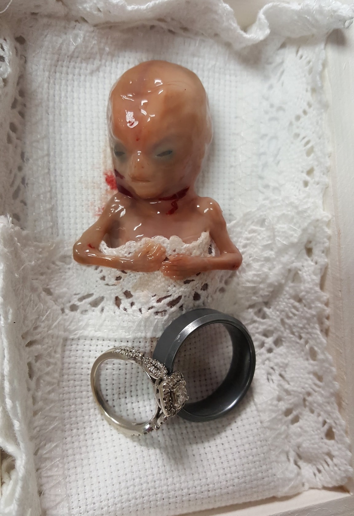 El médico de Sutherland le dijo que Miran murió a las 14 semanas. (Cortesía de <a href="https://www.facebook.com/MiransPurpose" target="_blank" rel="noopener">Mirans Purpose</a>)