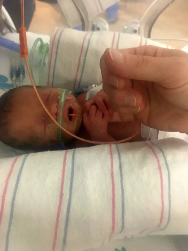 Jayden en la unidad de cuidados intensivos neonatales. (SWNS)