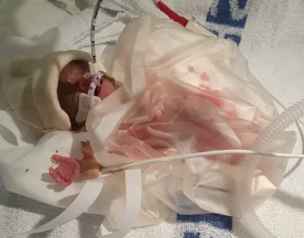 El bebé Larenz Carr nació a las 25 semanas el 28 de octubre de 2019, pesando menos de 1 libra. (SWNS)
