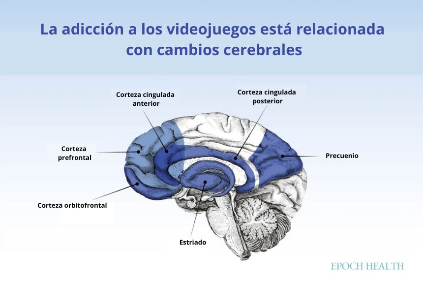 Los videojuegos pueden afectar muchas áreas de nuestro cerebro relacionadas con la adicción. (The Epoch Times)