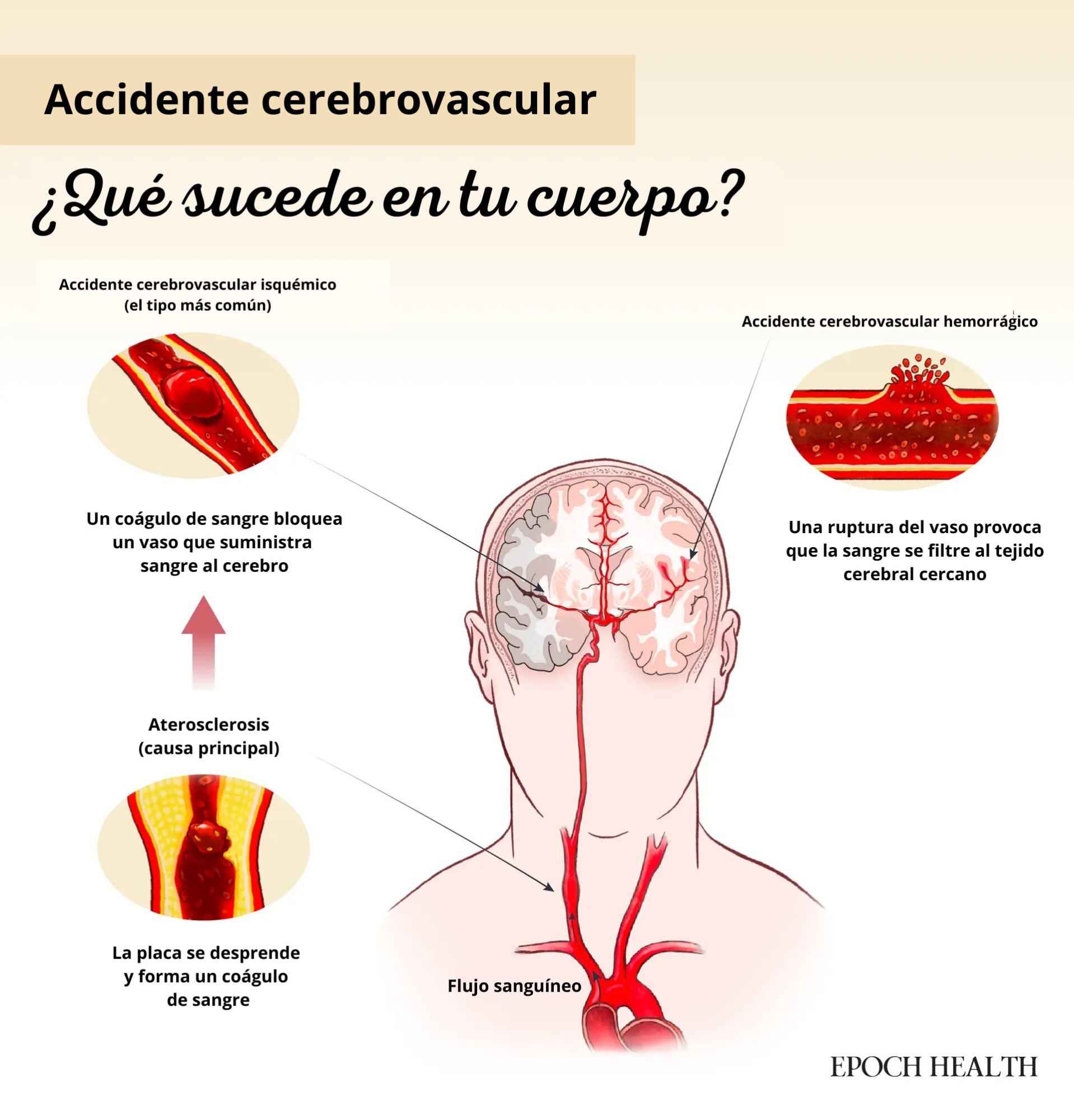 (Ilustración de The Epoch Times, Shutterstock)