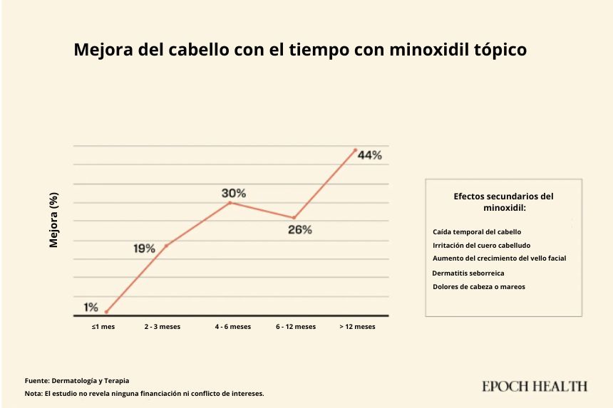 Después de más de un año de uso, el 44 % de los pacientes que persistieron con el tratamiento tópico con minoxidil reportaron una notable mejora en el crecimiento del cabello. (The Epoch Times)