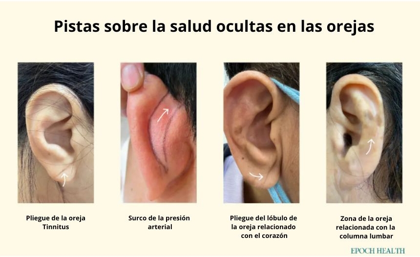 Pistas de salud ocultas en las orejas. (Cortesía de Hung-Chien Wu/The Epoch Times)