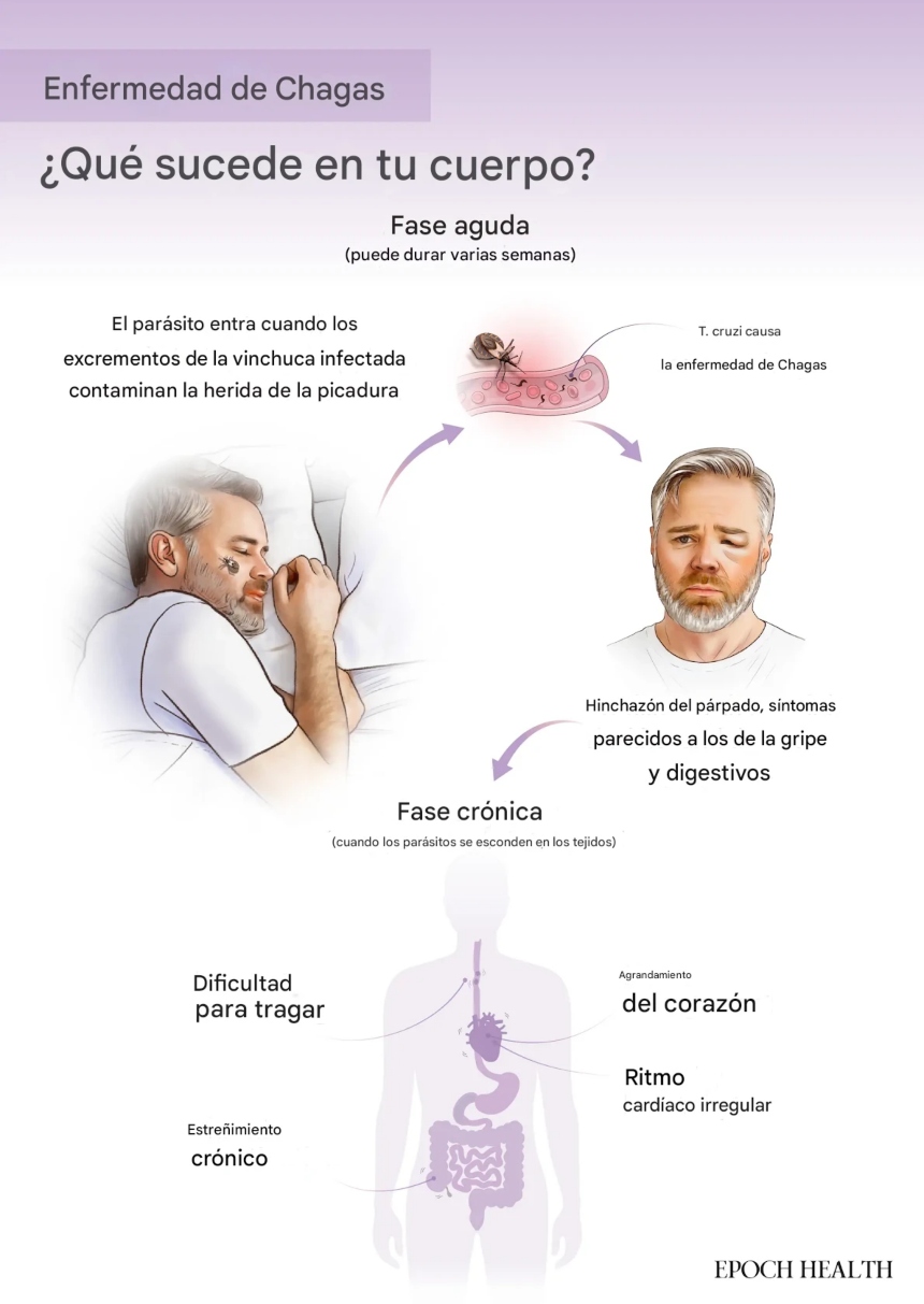 Enfermedad de Chagas. (Ilustración de The Epoch Times, Shutterstock)