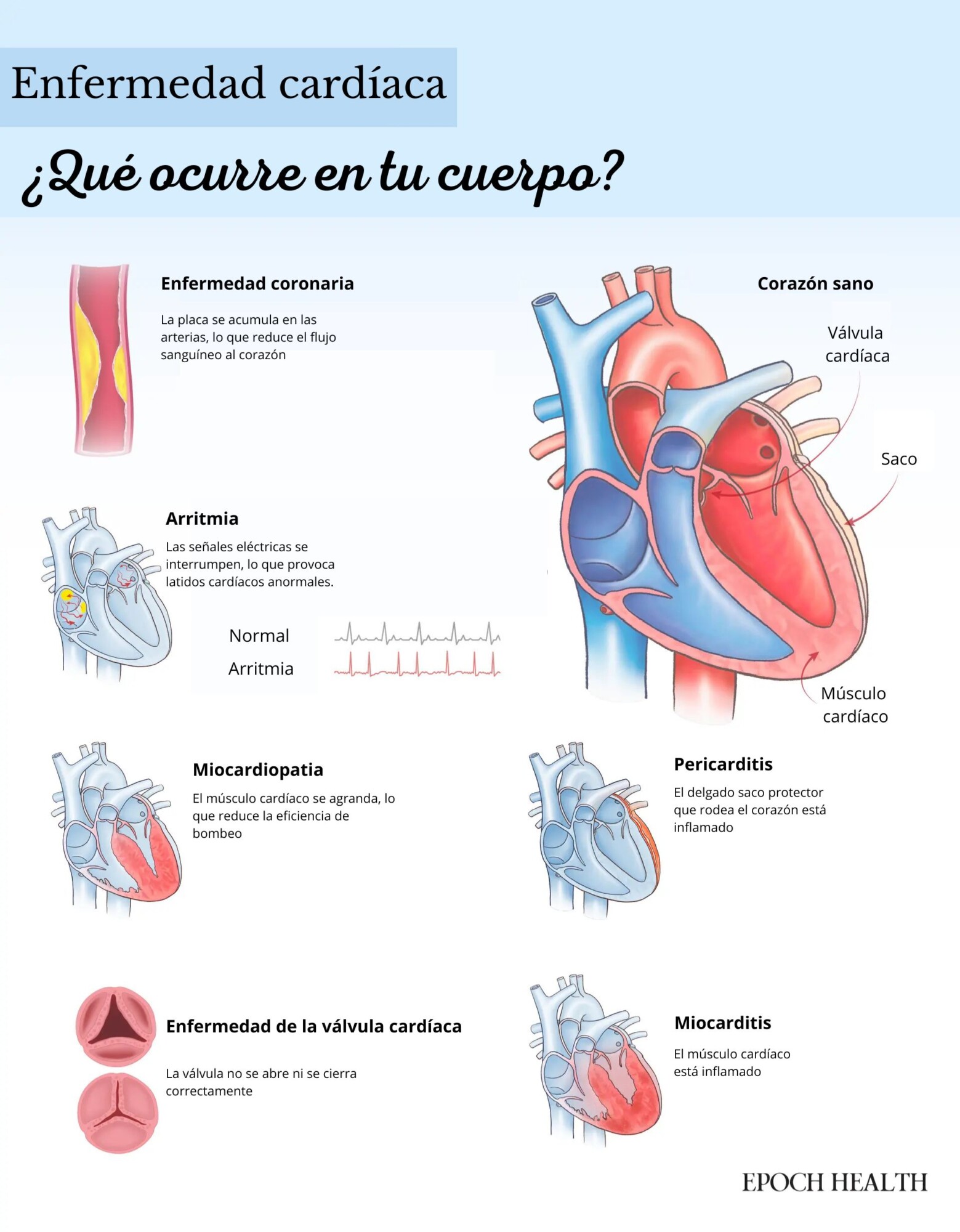 (Ilustración de The Epoch Times, Shutterstock)