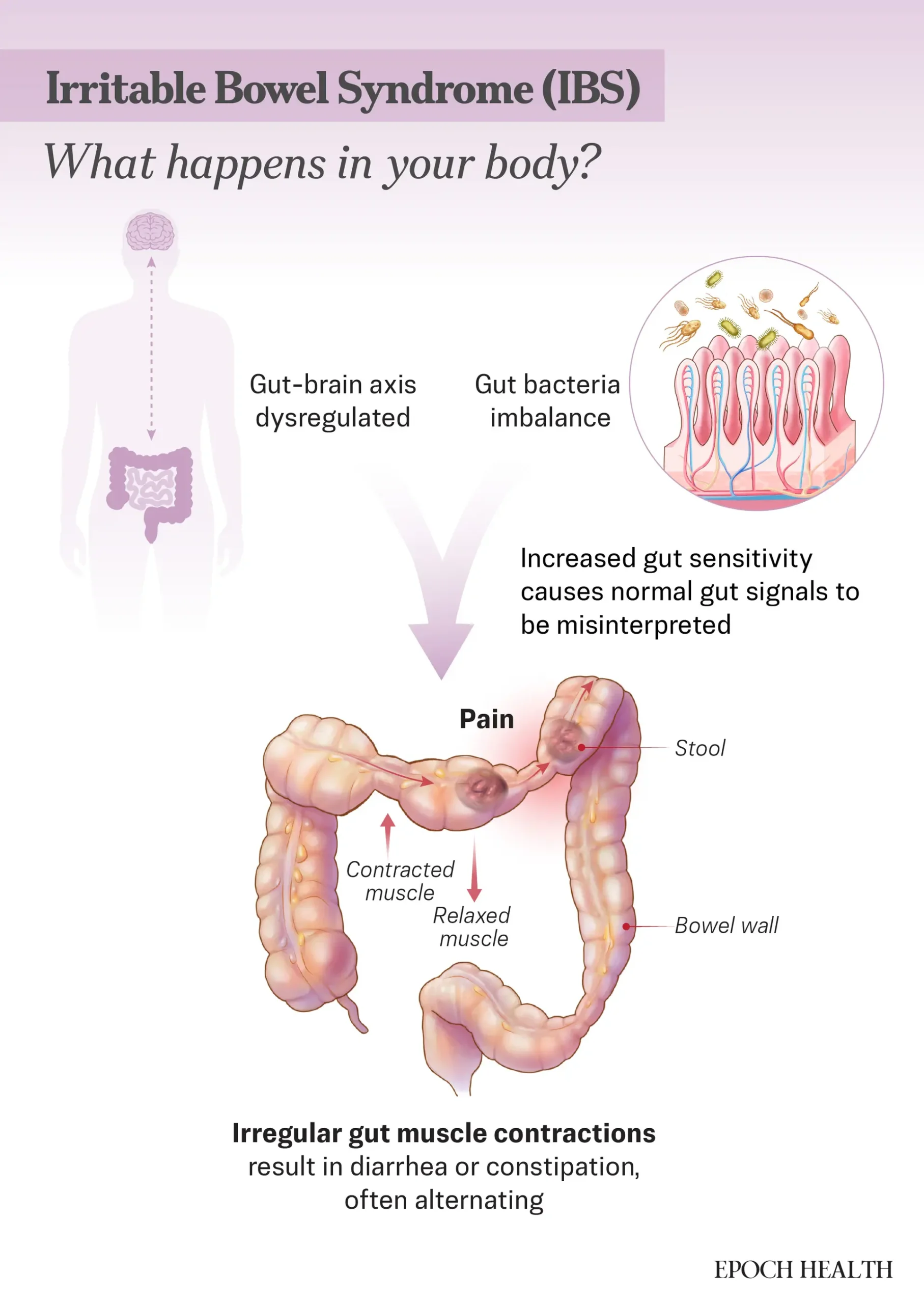 Ilustración de The Epoch Times, Shutterstock